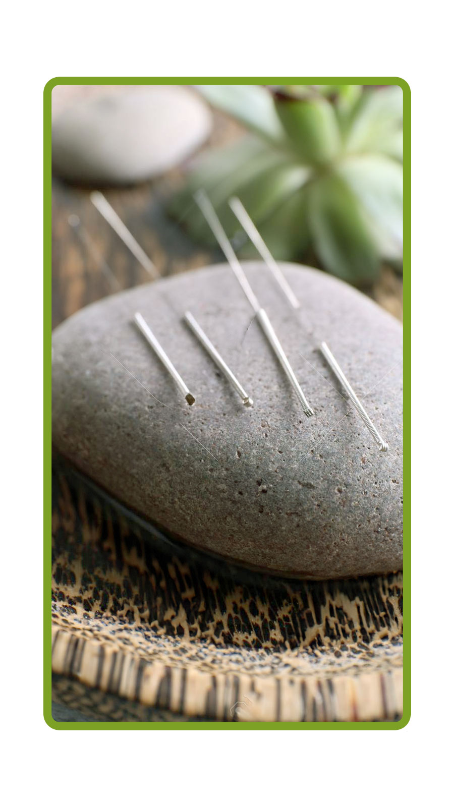 Acupuncture for the Athlete Image